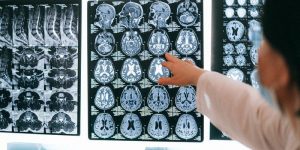 自尊与大脑的关系 自尊与大脑